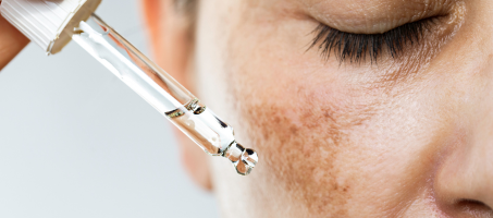 hydroquinone cancer